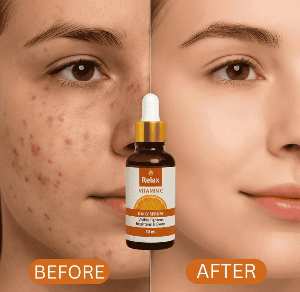Relax Vitamin C Daily Serum ( Net Quantity: 30ml ) - DGN Mart