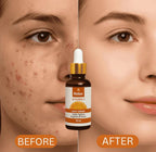 Relax Vitamin C Daily Serum ( Net Quantity: 30ml ) - DGN Mart