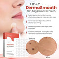 DermaSmooth Skin Tag Remover Patch - DGN Mart